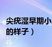 尖锐湿尤图症状图片男_尖锐湿疹图片初期症状图片男性_尖锐湿疹照片男性症状