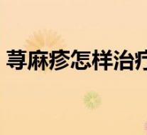 荨麻疹怎样治疗效果好呀（荨麻疹怎样治疗）