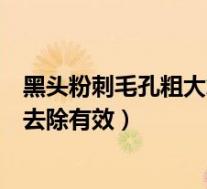 黑头粉刺毛孔粗大怎么去除最有效（黑头粉刺毛孔粗大怎么去除有效）