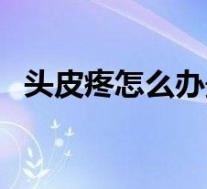 头皮疼怎么办最快最有效(头皮疼怎么办)