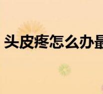 头皮疼怎么办最快最有效的(头皮疼怎么办)