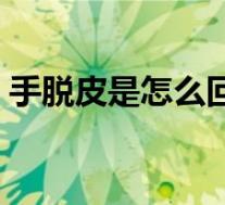 手脱皮是怎么回事男生(手脱皮是怎么回事)