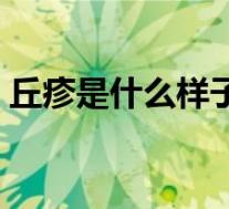 丘疹是什么样子的症状（丘疹是什么样子的）
