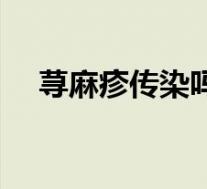 荨麻疹传染吗怎么传染(荨麻疹传染吗)