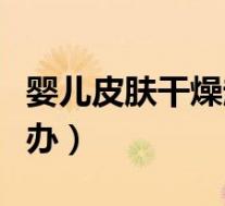 婴儿皮肤干燥起皮怎么办(皮肤干燥起皮怎么办)