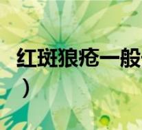 红斑狼疮一般长在哪(红斑狼疮主要长在哪里)