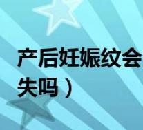 产后妊娠纹会消失吗怎么办（产后妊娠纹会消失吗）