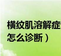 横纹肌溶解症诊断标准是什么（横纹肌溶解症怎么诊断）