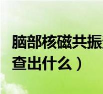 脑部核磁共振查什么毛病（脑部核磁共振能检查出什么）